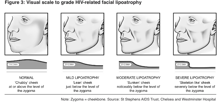 What is lipodystrophy and how is it related to HIV treatment? What is lipodystrophy and how is it related to HIV treatment?