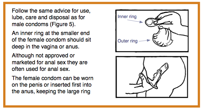 Female Condom Anal