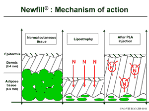 Newfill - how it works